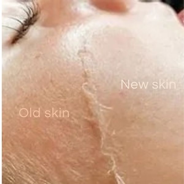 Dermaplaning – A key service for maximum skin health! 